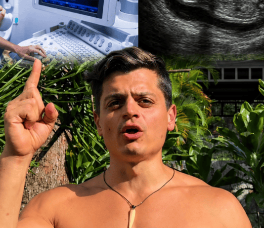 Gianpiero Fusco recibe críticas de médicos tras cuestionar el uso de ecografías Gianpiero Fusco durante el video en el que cuestiona el uso de ecografías